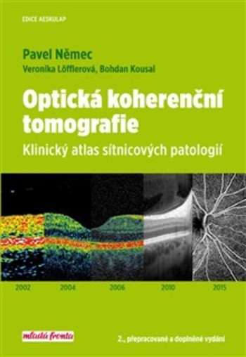 Optická koherenční tomografie – Klinický atlas sítnicových patologií