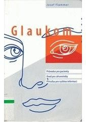 Glaukom průvodce pro pacienty