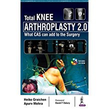 Total Knee Arthroplasty 2.0