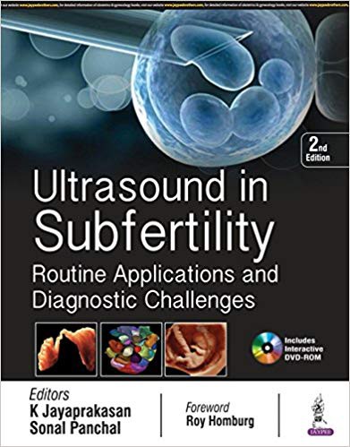 Ultrasound in Subfertility: Routine Applications and Diagnostic Challenges