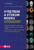 Vyšetření a výzkum mozku Vyšetření a výzkum mozku