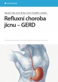 Refluxní choroba jícnu – GERD Refluxní choroba jícnu – GERD