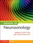 Manual of Neurosonology Manual of Neurosonology