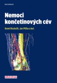 Nemoci končetinových cév Nemoci končetinových cév