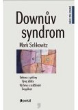 Downův syndrom Downův syndrom