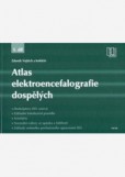 Atlas elektroencefalografie dospělých - 1. díl Atlas elektroencefalografie dospělých - 1. díl
