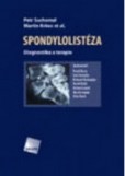 Spondylolistéza