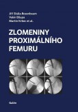 Zlomeniny proximálního femuru Zlomeniny proximálního femuru