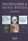 Encefalokéla spina bifida