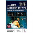 Total Knee Arthroplasty 2.0 Total Knee Arthroplasty 2.0