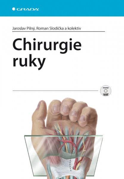 Chirurgie ruky Chirurgie ruky