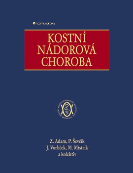 Kostní nádorová choroba Kostní nádorová choroba