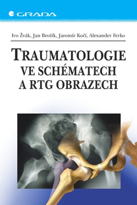 Traumatologie ve schématech a RTG obrazech