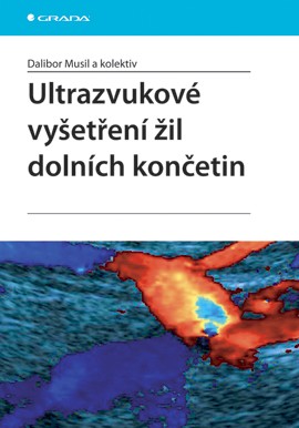 Ultrazvukové vyšetření žil dolních končetin Ultrazvukové vyšetření žil dolních končetin