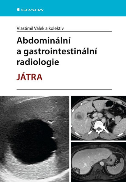 Abdominální a gastrointestinální radiologie Abdominální a gastrointestinální radiologie