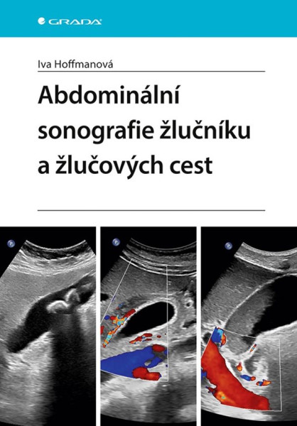 Abdominální sonografie žlučníku a žlučových cest Abdominální sonografie žlučníku a žlučových cest