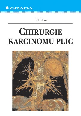Chirurgie karcinomu plic Chirurgie karcinomu plic