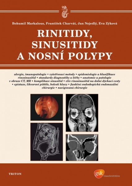 Rinitidy, sinusitidy a nosní polypy Rinitidy, sinusitidy a nosní polypy
