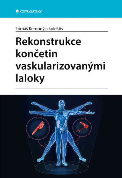Rekonstrukce končetin vaskularizovanými laloky Rekonstrukce končetin vaskularizovanými laloky