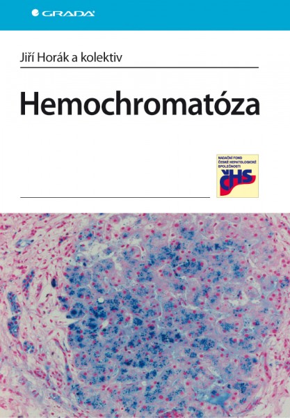 Hemochromatóza Hemochromatóza