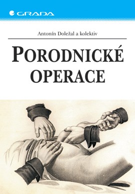 Porodnické operace Porodnické operace
