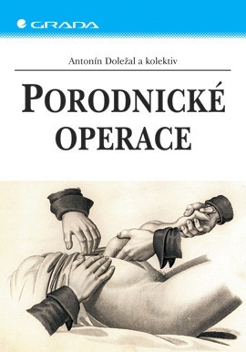 Porodnické operace Porodnické operace