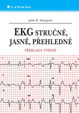 EKG stručně, jasně, přehledně EKG stručně, jasně, přehledně