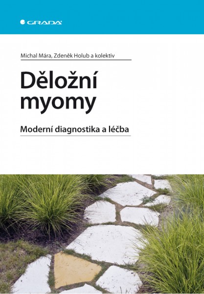 Děložní myomy Děložní myomy