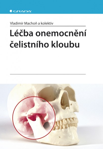 Léčba onemocnění čelistního kloubu Léčba onemocnění čelistního kloubu