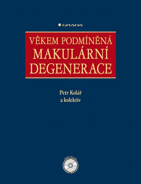 Věkem podmíněná makulární degenerace