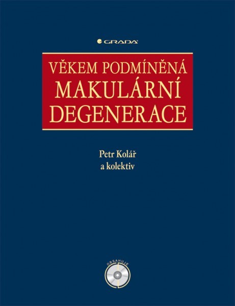 Věkem podmíněná makulární degenerace