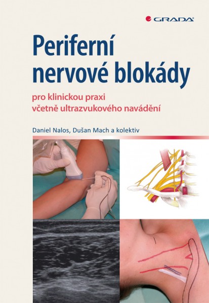 Periferní nervové blokády Periferní nervové blokády