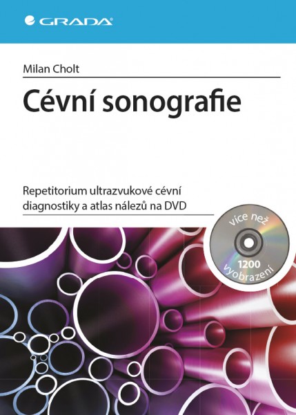 Cévní sonografie Cévní sonografie