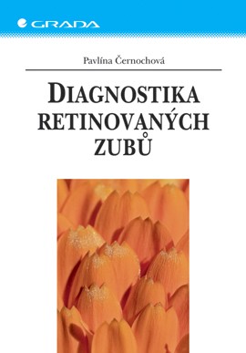 Diagnostika retinovaných zubů Diagnostika retinovaných zubů