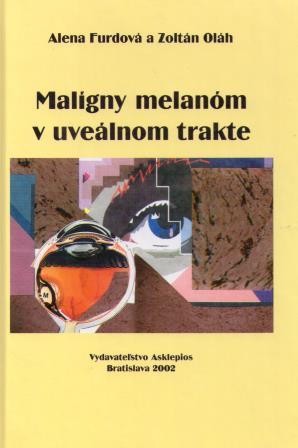 Malígny melanóm v uveálnom trakte