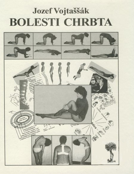 Bolesti chrbta Bolesti chrbta