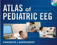 Atlas of Pediatric EEG Atlas of Pediatric EEG