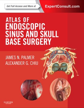 Atlas of Endoscopic Sinus and Skull Base Surgery Atlas of Endoscopic Sinus and Skull Base Surgery