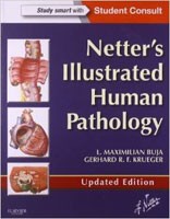 Netter´s Illustrated Human Pathology Netter´s Illustrated Human Pathology