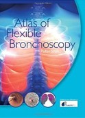 Atlas of Flexible Bronchoscopy Atlas of Flexible Bronchoscopy