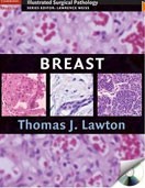 Breast