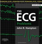 150 ECG Problems 150 ECG Problems