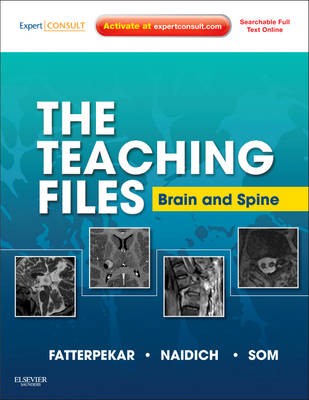 The Teaching Files:  Brain and Spine