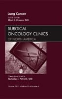Lung Cancer, An Issue of Surgical Oncology Clinics Lung Cancer, An Issue of Surgical Oncology Clinics