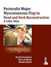 Handbook of Reconstructive Flaps
