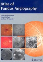 Atlas of Fundus Angiography Atlas of Fundus Angiography
