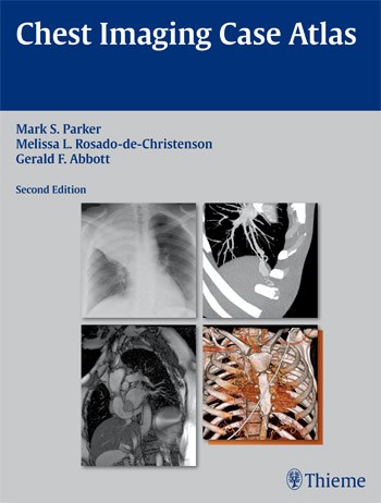 Chest Imaging Case Atlas Chest Imaging Case Atlas