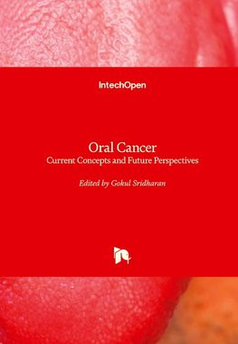 Oral Cancer Oral Cancer