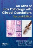 Atlas of Hair Pathology with Clinical Correlations