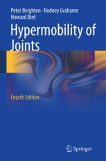 Hypermobility of Joints Hypermobility of Joints